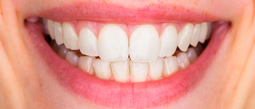 Estética Dental Clínica New dental Toledo