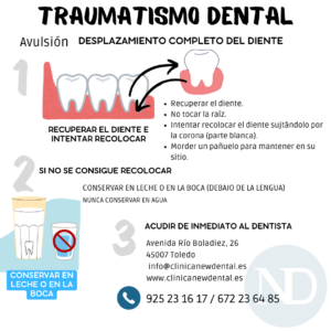 Lee más sobre el artículo Traumatismos en dientes permanentes: Desplazamiento completo de un diente.