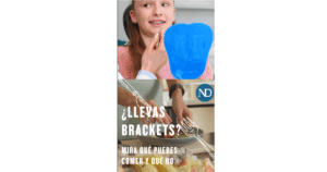 Lee más sobre el artículo ¿Qué puedes y qué no puedes comer con brackets?