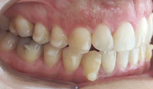 [TN640x400]-VOI47544561_i_buccal_right