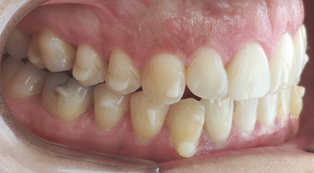 [TN640x400]-VOI47544561_i_buccal_right