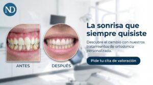 Lee más sobre el artículo La transformación de una sonrisa: así es un proceso de ortodoncia paso a paso en Toledo